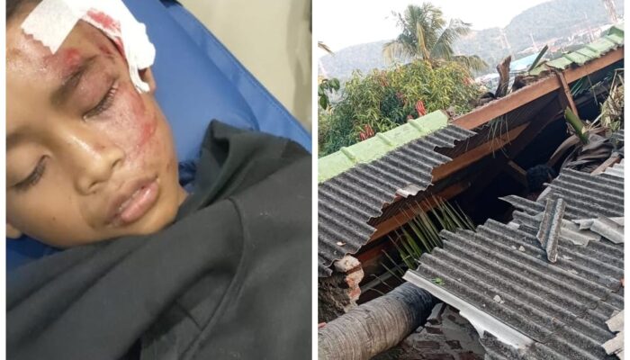 Bocah SD di Tamansari Tertimpa Pohon Kelapa, Camat Pulomerak Akui Kejadian